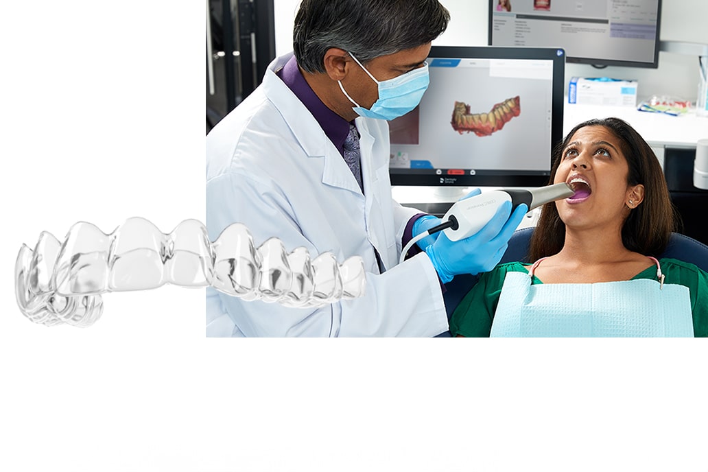 マウスピース矯正