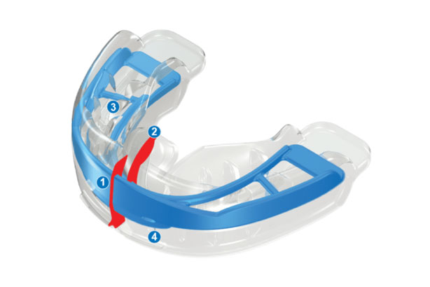 マイオブレース