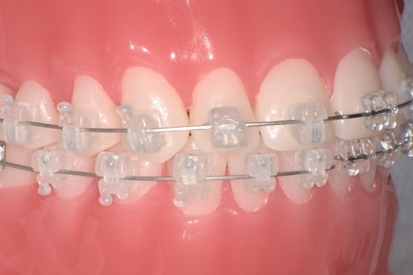 ホワイトワイヤー