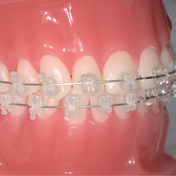 セルフライゲーション