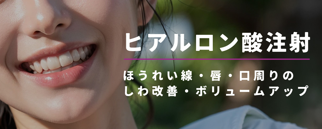 ヒアルロン注射