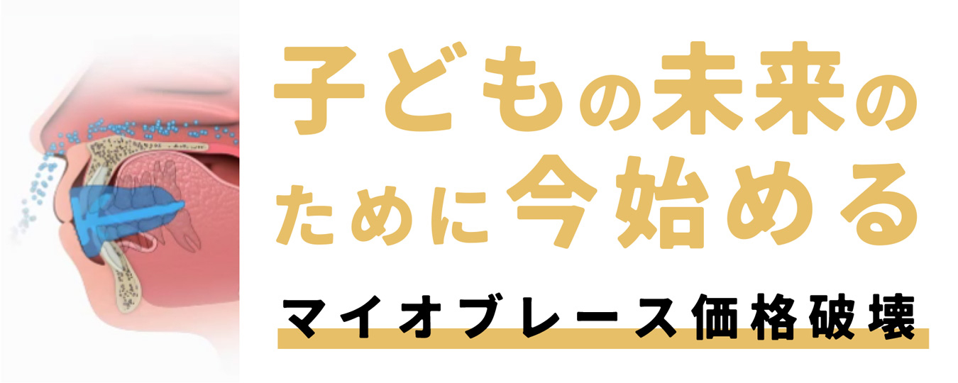 マイオブレース